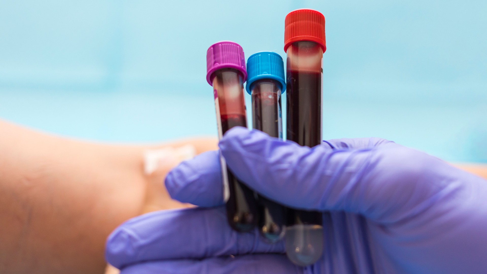 Blood test vials for blood groups held by nurse. Blood analysis concept, selective focus, copy space